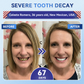 Velaukgoods® 🦷 Tideglusib Fast‑Dissolving Tooth & Gum Repair Oral Strips ✨