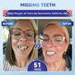 Velaukgoods® 🦷 Tideglusib Fast‑Dissolving Tooth & Gum Repair Oral Strips ✨